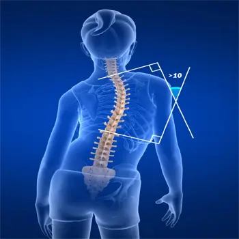Pediatric scoliosis specialist Nagpur