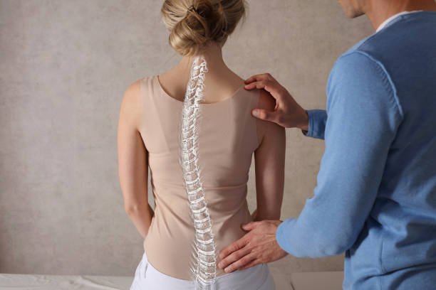 Scoliosis is complex spinal condition characterized abnormal curvature of spine. It can occur at any age, but it most commonly develops in children and adolescents.