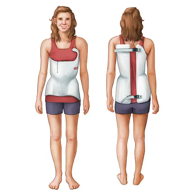 Scoliosis treatment in Nagpur