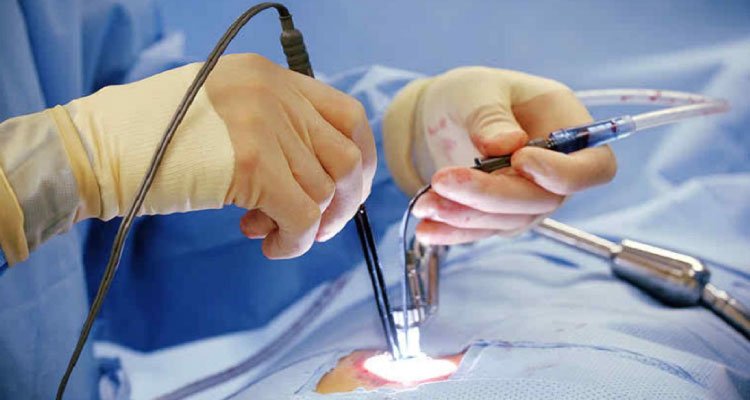 keyhole-spine-surgery-03
